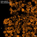 early embryo: late gastrula stage, mid-gastrula stage, mid-mesenchyme blastula stage (HCR signal)