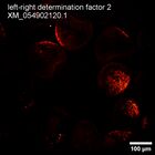 early embryo: late gastrula stage, mid-gastrula stage, mid-mesenchyme blastula stage (HCR signal)