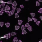 gastrula–juvenile: mid-gastrula stage (DAPI overlay)