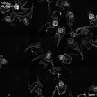 gastrula–juvenile: early feeding larva period (HCR signal)