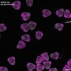 gastrula–juvenile: mid-gastrula stage (DAPI overlay)