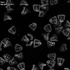gastrula–juvenile: mid-gastrula stage (HCR signal)