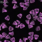 gastrula–juvenile: mid-gastrula stage (DAPI overlay)
