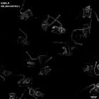 gastrula–juvenile: early feeding larva period (HCR signal)
