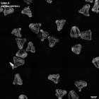 gastrula–juvenile: mid-gastrula stage (HCR signal)