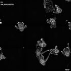 gastrula–juvenile: early feeding larva period (HCR signal)