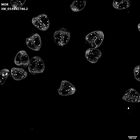 gastrula–juvenile: mid-gastrula stage (HCR signal)