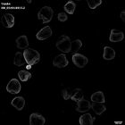 gastrula–juvenile: mid-gastrula stage (HCR signal)