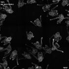 gastrula–juvenile: early feeding larva period (HCR signal)