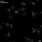 gastrula–juvenile: early feeding larva period (HCR signal)