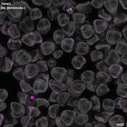 gastrula–juvenile: mid-gastrula stage (DAPI overlay)