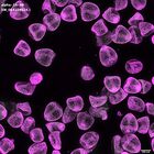 gastrula–juvenile: mid-gastrula stage (DAPI overlay)