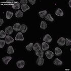 gastrula–juvenile: mid-gastrula stage (DAPI overlay)