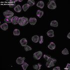 gastrula–juvenile: mid-gastrula stage (DAPI overlay)