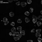 gastrula–juvenile: mid-gastrula stage (HCR signal)