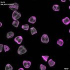 gastrula–juvenile: mid-gastrula stage (DAPI overlay)