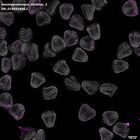 gastrula–juvenile: mid-gastrula stage (DAPI overlay)