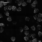 gastrula–juvenile: mid-gastrula stage (HCR signal)