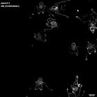 gastrula–juvenile: early feeding larva period (HCR signal)