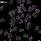 gastrula–juvenile: mid-gastrula stage (DAPI overlay)