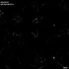 gastrula–juvenile: early feeding larva period (HCR signal)