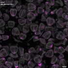 gastrula–juvenile: mid-gastrula stage (DAPI overlay)