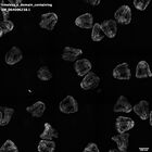gastrula–juvenile: mid-gastrula stage (HCR signal)