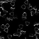gastrula–juvenile: mid-gastrula stage (HCR signal)